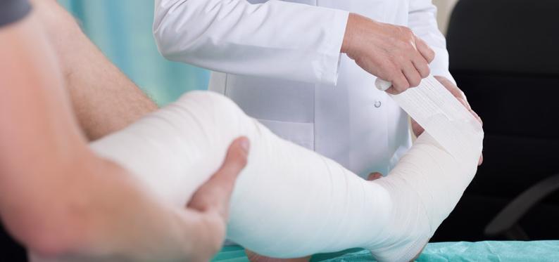 Doctor applying a cast to accident injury victim