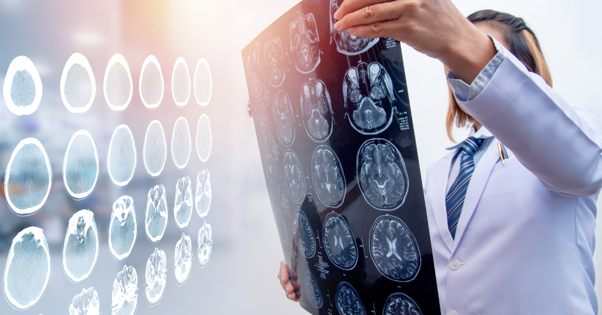 signs of traumatic brain injury