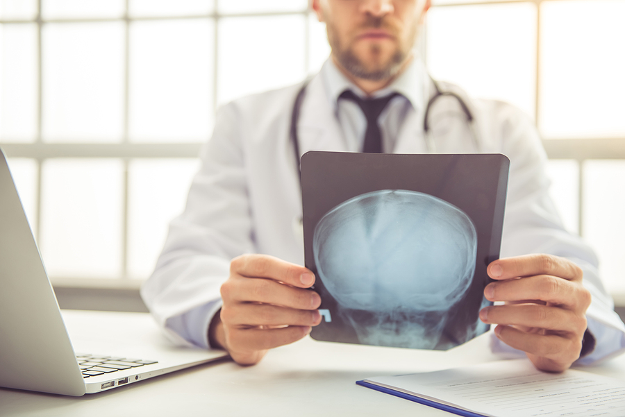 Is a Concussion Considered a Traumatic Brain Injury?