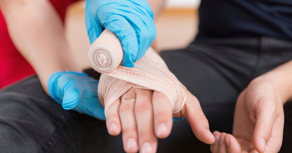 burn injuries