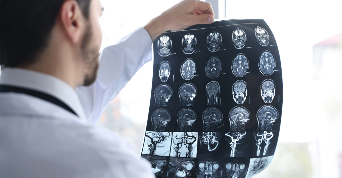 Doctor reviewing brain scans for possible signs of a traumatic brain injury.