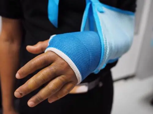 A photograph of a man with his arm in a cast after being injured in a bicycle accident.