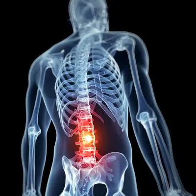 An x-ray highlighting an injury to a spinal cord.